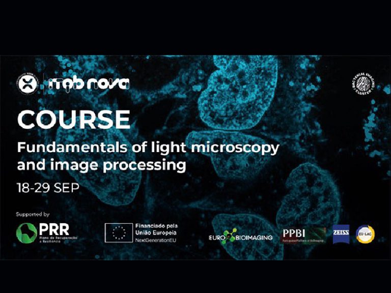FUNDAMENTALS OF LIGHT MICROSCOPY & IMAGE PROCESSING